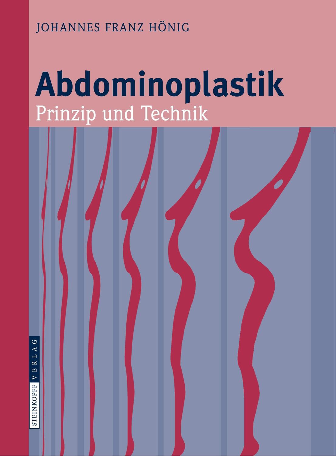 Cover: 9783798518162 | Abdominoplastik | Prinzip und Technik | Johannes-Franz Hönig | Buch