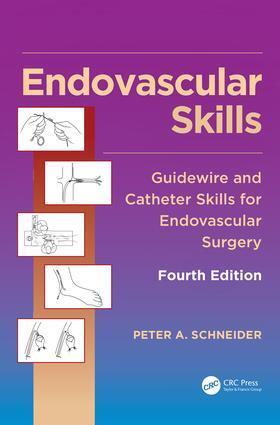 Cover: 9781482217377 | Endovascular Skills | Peter Schneider | Buch | Englisch | 2019