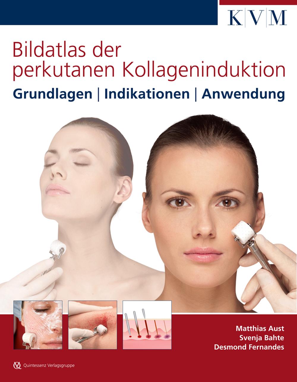 Cover: 9783940698858 | Bildatlas der perkutanen Kollageninduktion | Matthias Aust (u. a.)