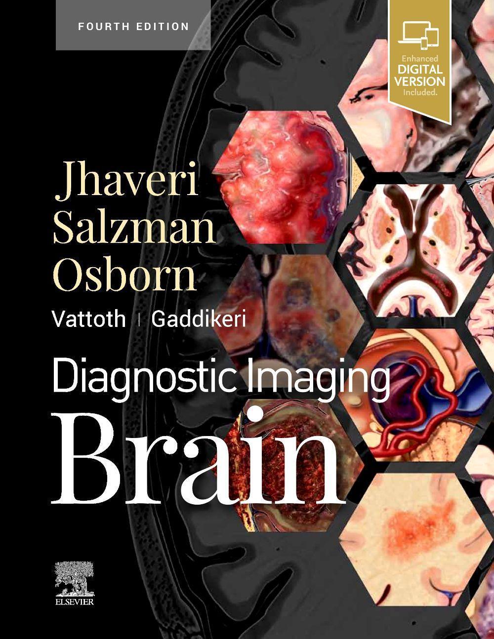 Cover: 9780323756204 | Diagnostic Imaging: Brain | Miral D Jhaveri | Buch | Englisch | 2020
