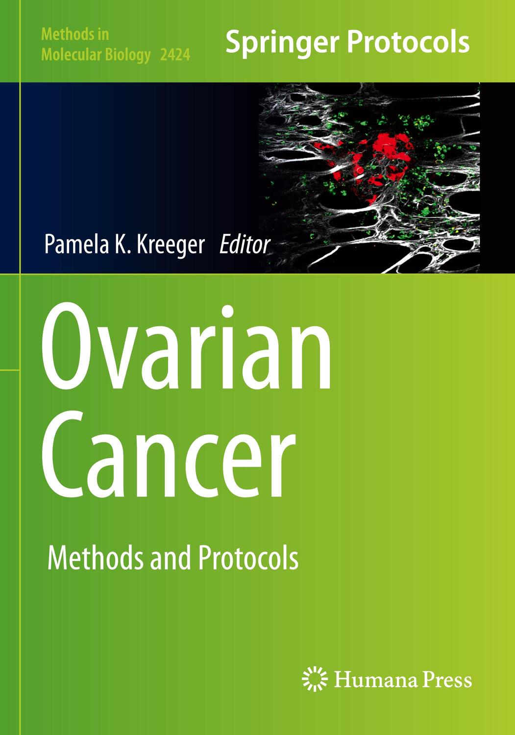 Cover: 9781071619582 | Ovarian Cancer | Methods and Protocols | Pamela K. Kreeger | Buch