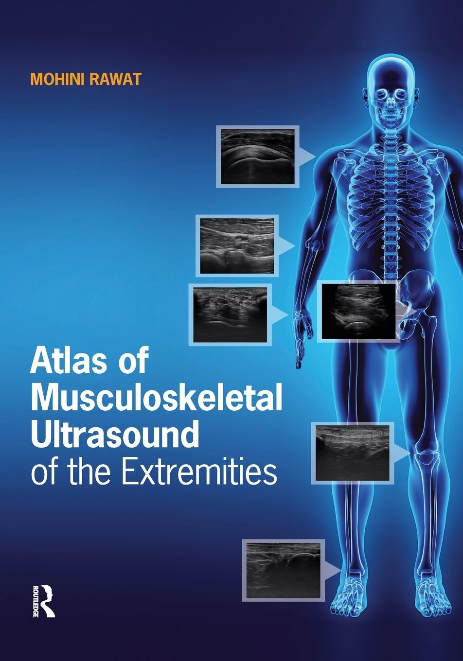 Cover: 9781630916022 | Atlas of Musculoskeletal Ultrasound of the Extremities | Mohini Rawat