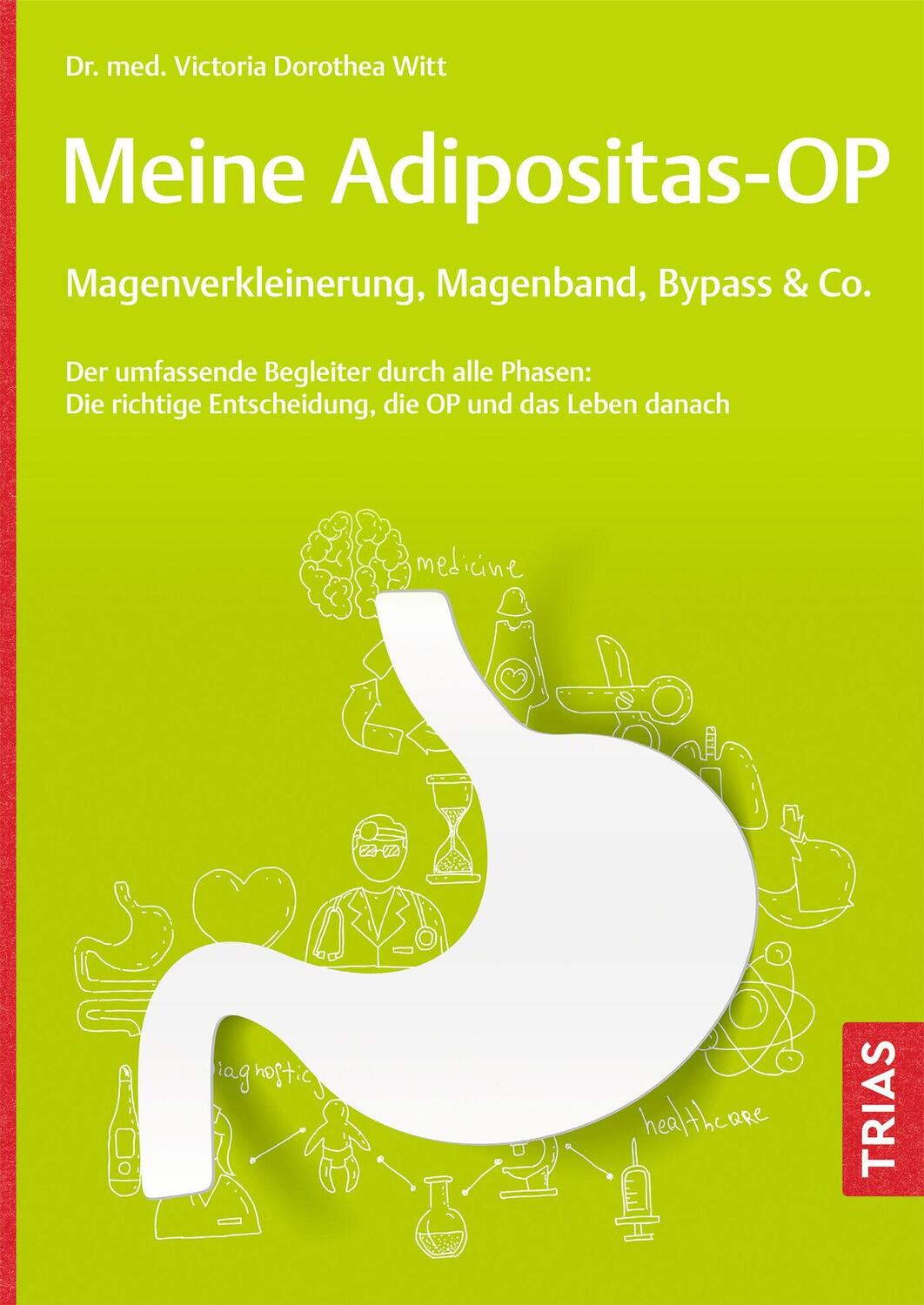 Cover: 9783432118222 | Meine Adipositas-OP. Magenverkleinerung, Magenband, Bypass &amp; Co.