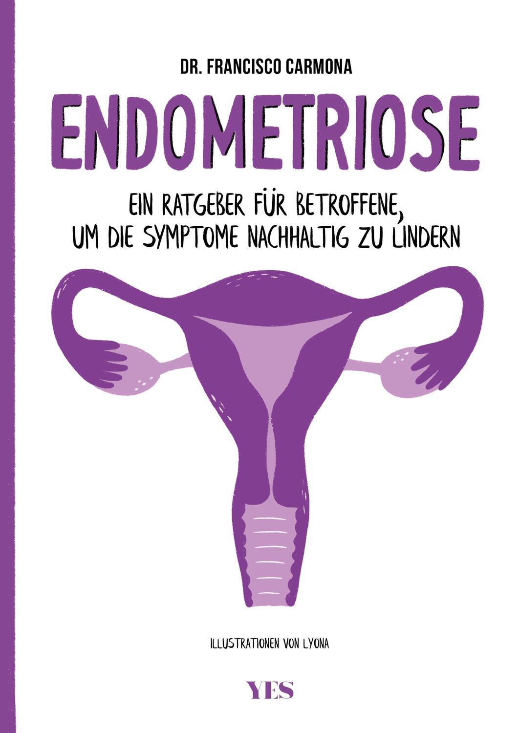 Cover: 9783969051542 | Endometriose | Francisco Carmona | Taschenbuch | Deutsch | 2022
