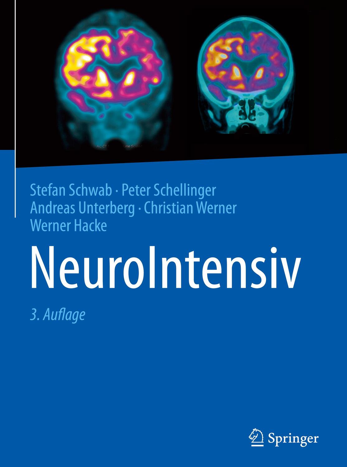 Cover: 9783662464991 | NeuroIntensiv | Stefan Schwab (u. a.) | Buch | Springer