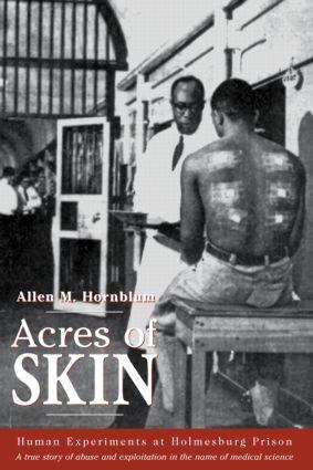 Cover: 9780415923361 | Acres of Skin | Human Experiments at Holmesburg Prison | Hornblum