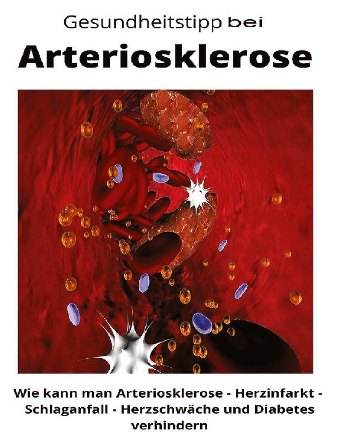 Cover: 9783347760394 | Gesundheitstipp bei Arteriosklerose | Maximilian Loidl | Taschenbuch