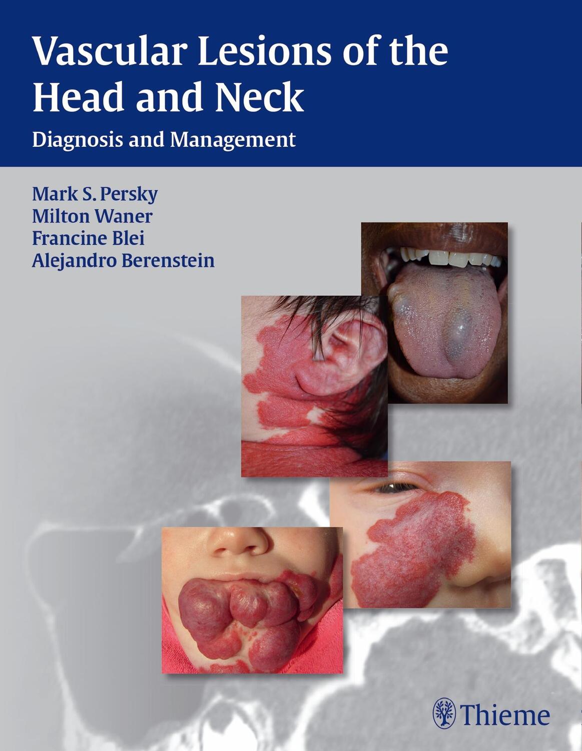 Cover: 9781604060591 | Vascular Lesions of the Head and Neck | Diagnosis and Management