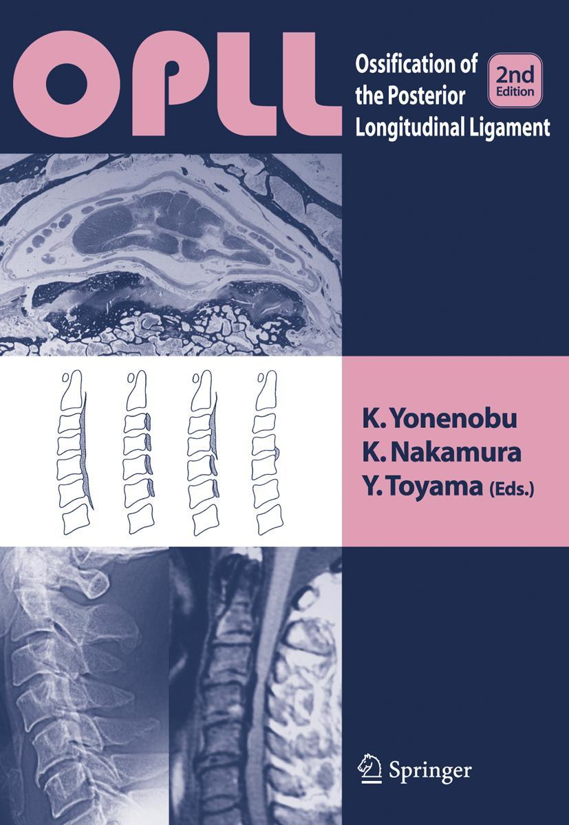 Cover: 9784431560463 | OPLL | Ossification of the Posterior Longitudinal Ligament | Buch