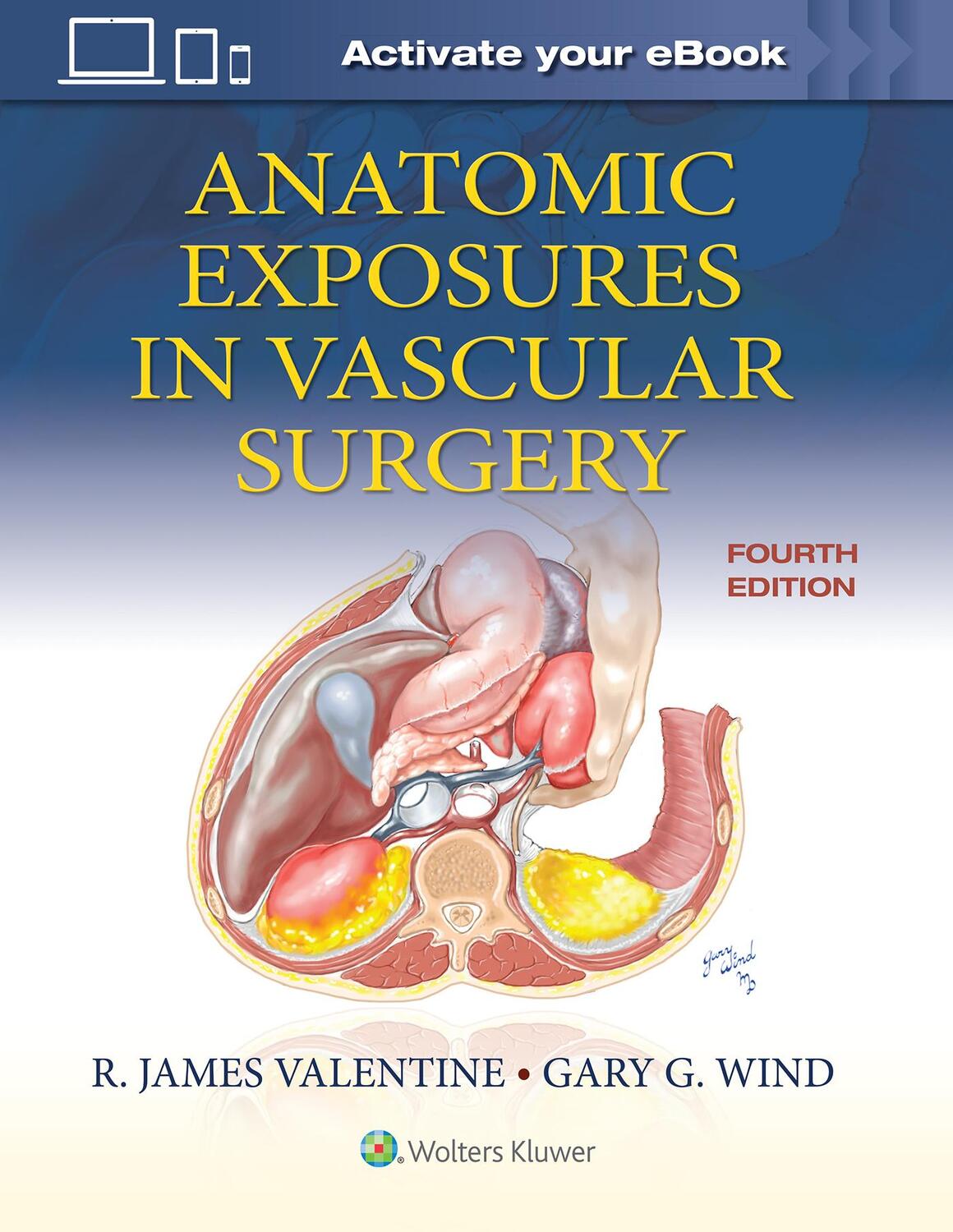 Cover: 9781975152765 | Anatomic Exposures in Vascular Surgery | Gary Wind | Buch | Englisch