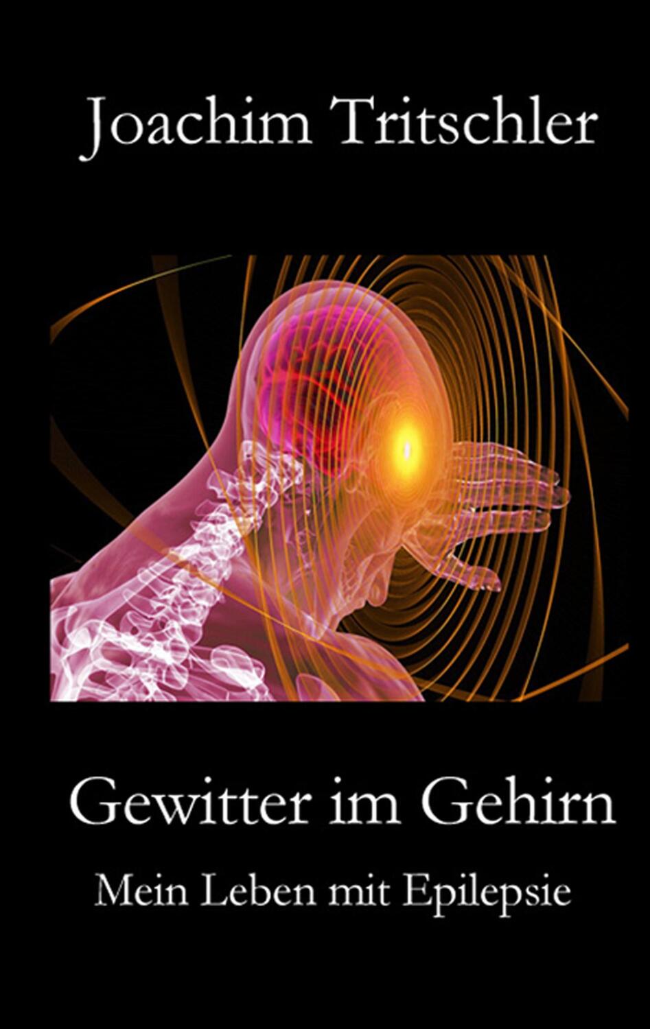 Cover: 9783749483143 | Gewitter im Gehirn | Mein Leben mit Epilepsie | Joachim Tritschler