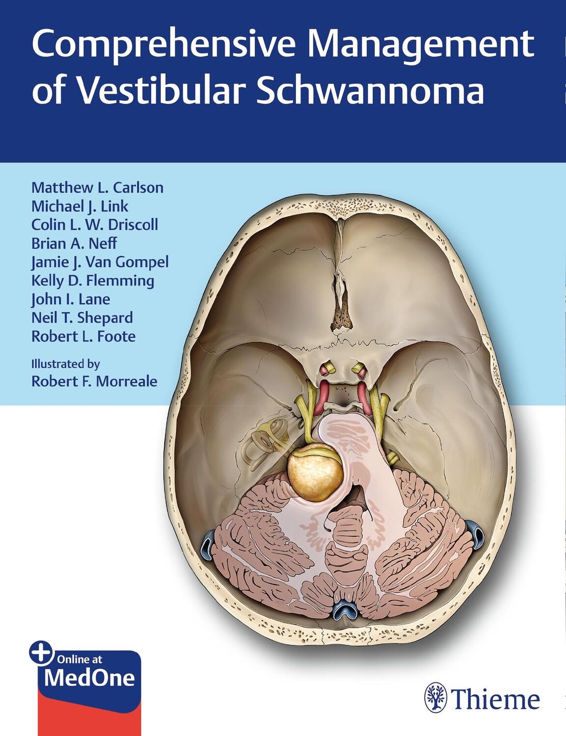 Cover: 9781626233317 | Comprehensive Management of Vestibular Schwannoma | Carlson (u. a.)