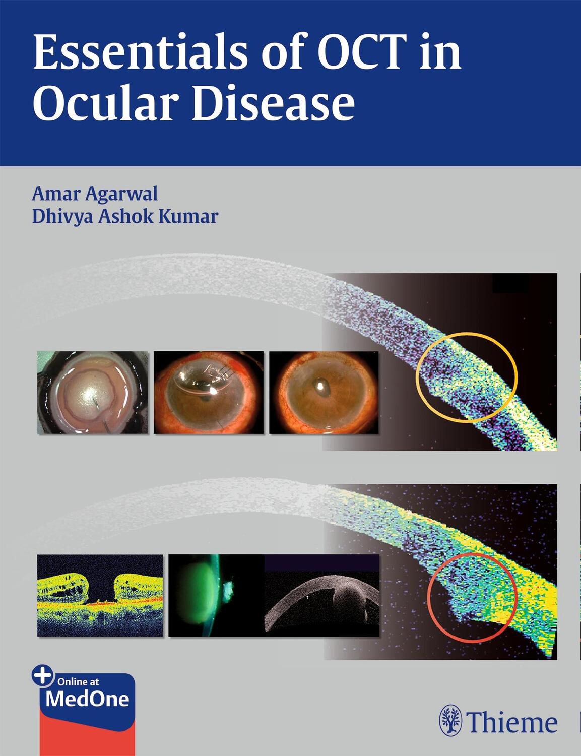 Cover: 9781626230989 | Essentials of Oct in Ocular Disease | Amar Agarwal (u. a.) | Buch