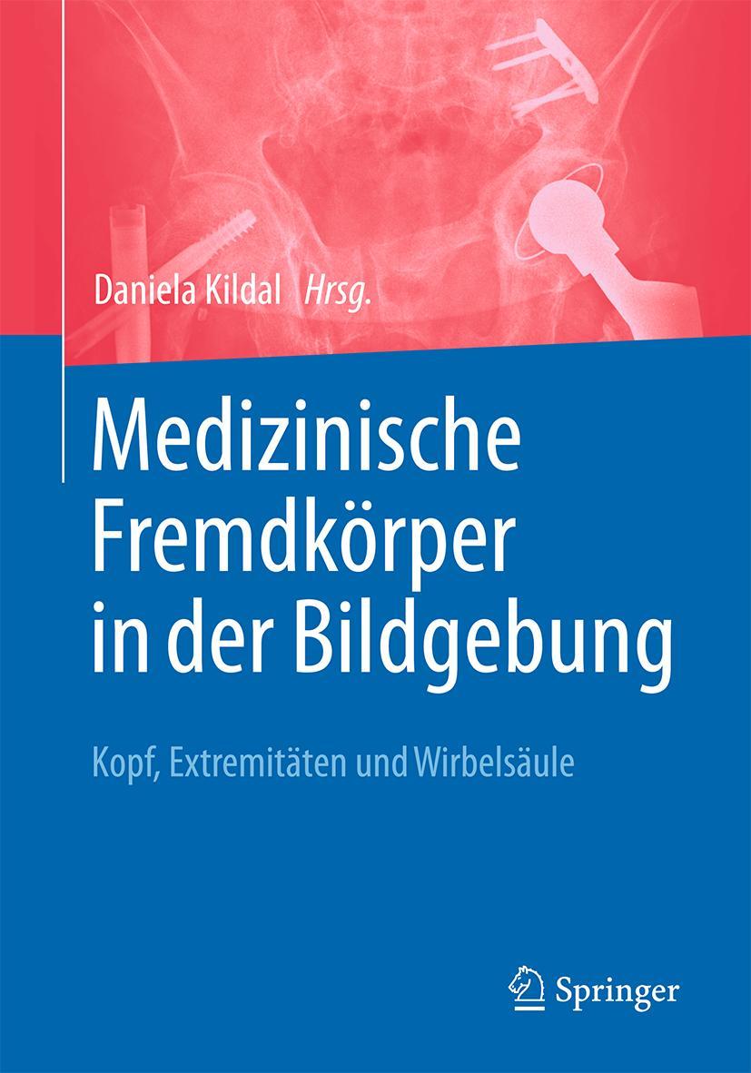 Cover: 9783662537497 | Medizinische Fremdkörper in der Bildgebung | Daniela Kildal | Buch