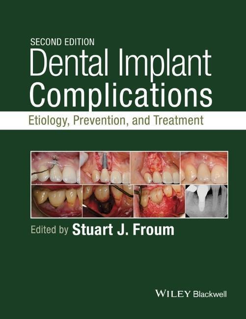Cover: 9781118976456 | Dental Implant Complications | Etiology, Prevention, and Treatment