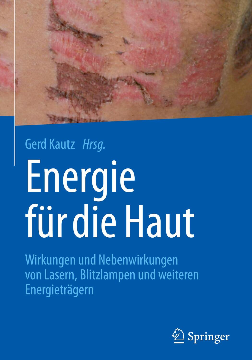 Cover: 9783662564356 | Energie für die Haut | Gerd Kautz | Buch | Springer