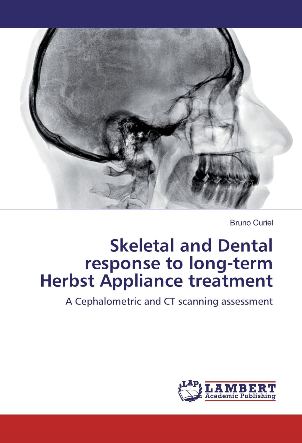 Cover: 9783659824302 | Skeletal and Dental response to long-term Herbst Appliance treatment