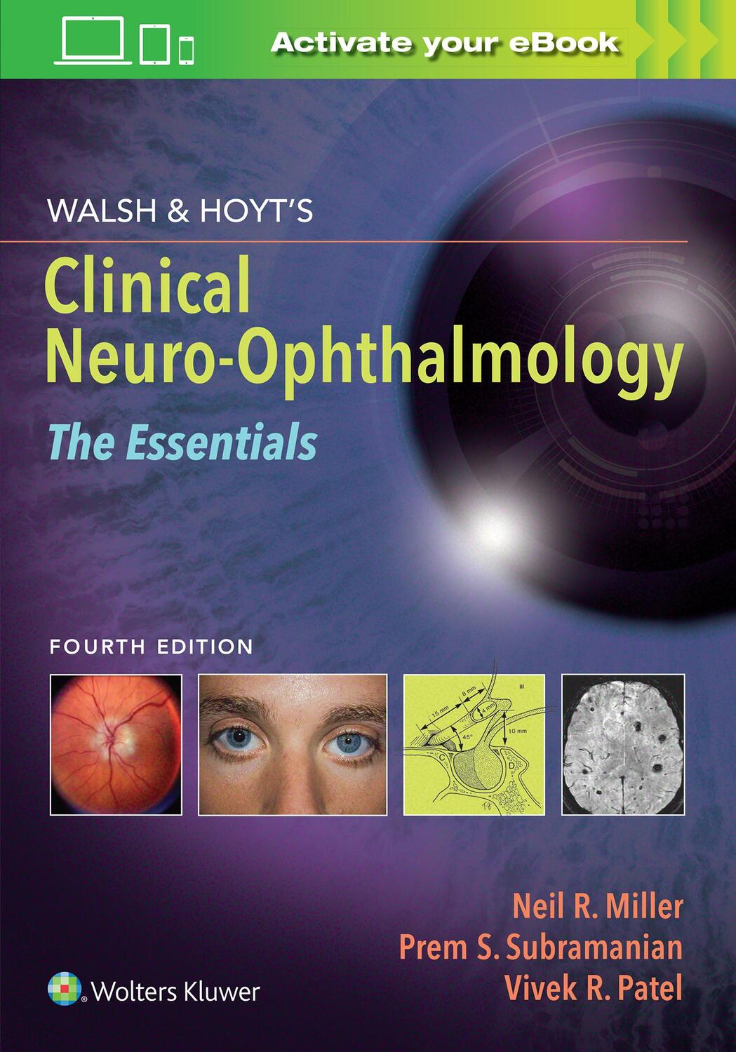 Cover: 9781975118914 | Walsh & Hoyt's Clinical Neuro-Ophthalmology: The Essentials | Buch