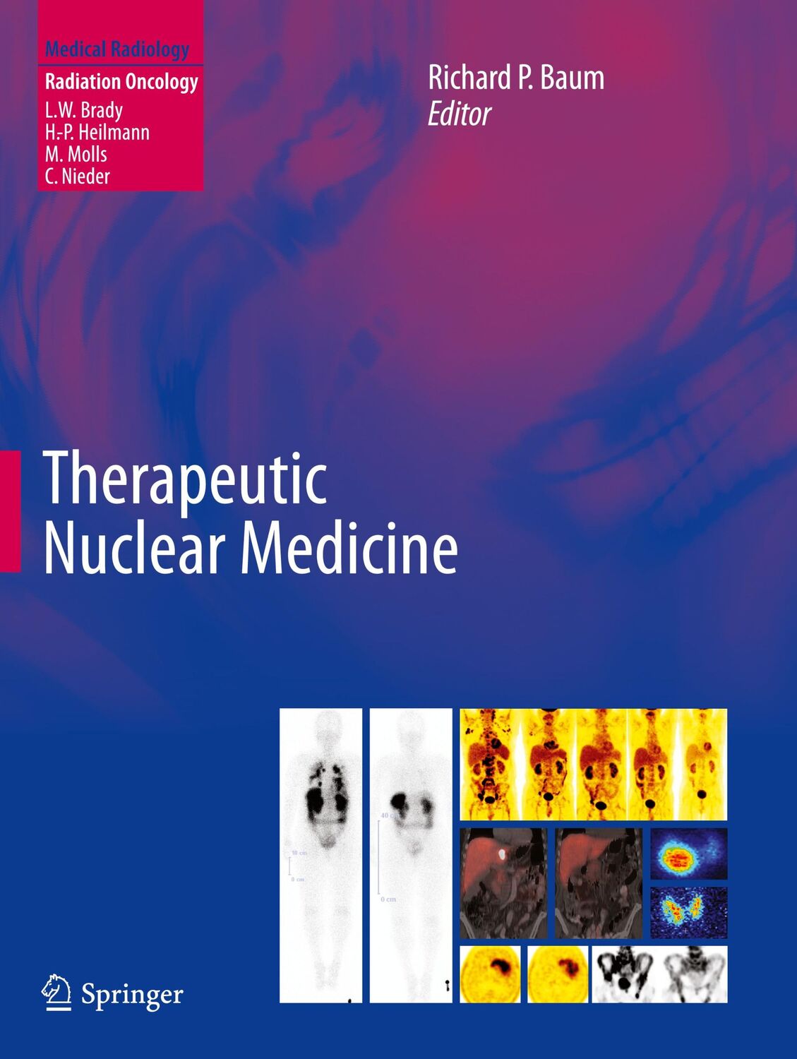 Cover: 9783662518205 | Therapeutic Nuclear Medicine | Richard P. Baum | Taschenbuch | xviii