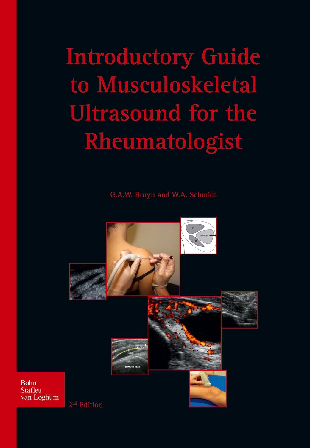 Cover: 9789031389018 | Introductory guide to musculoskeletal ultrasound for the...