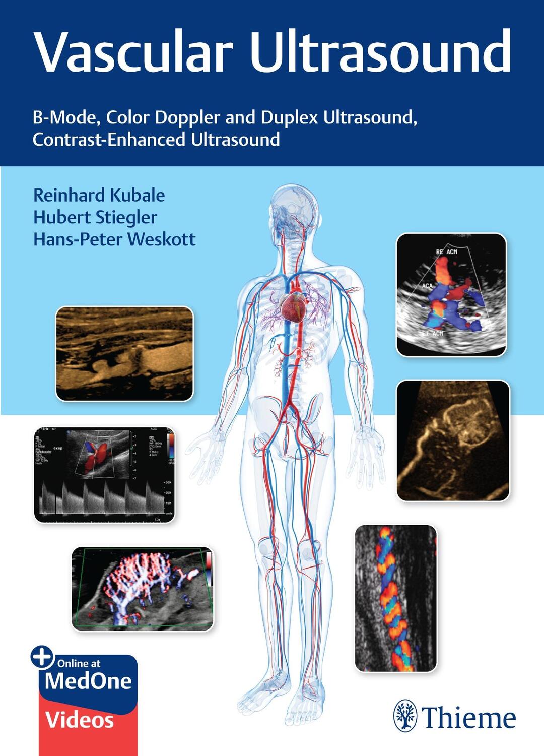 Cover: 9783132405431 | Vascular Ultrasound | Reinhard Kubale (u. a.) | Bundle | 1 Buch | 2023