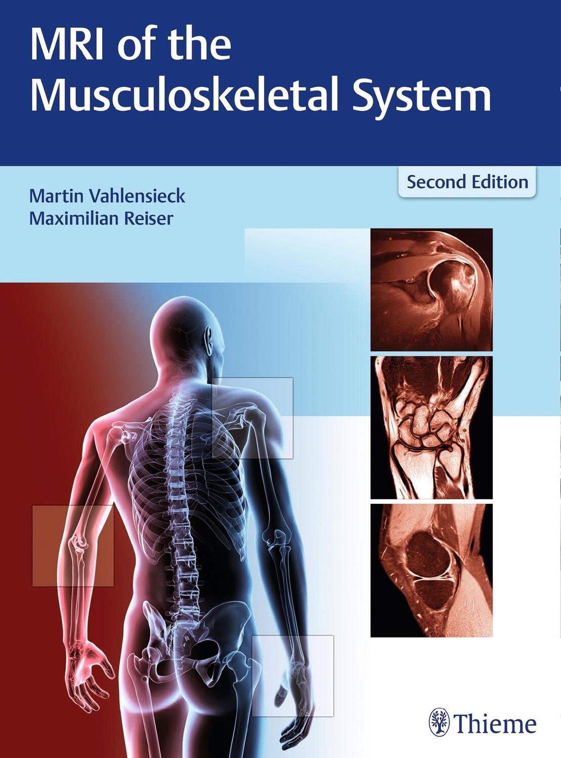 Cover: 9783131165725 | MRI of the Musculoskeletal System | Martin Vahlensieck (u. a.) | Buch
