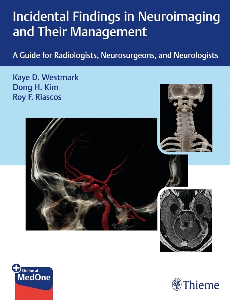 Cover: 9781626238282 | Incidental Findings in Neuroimaging and Their Management | Bundle