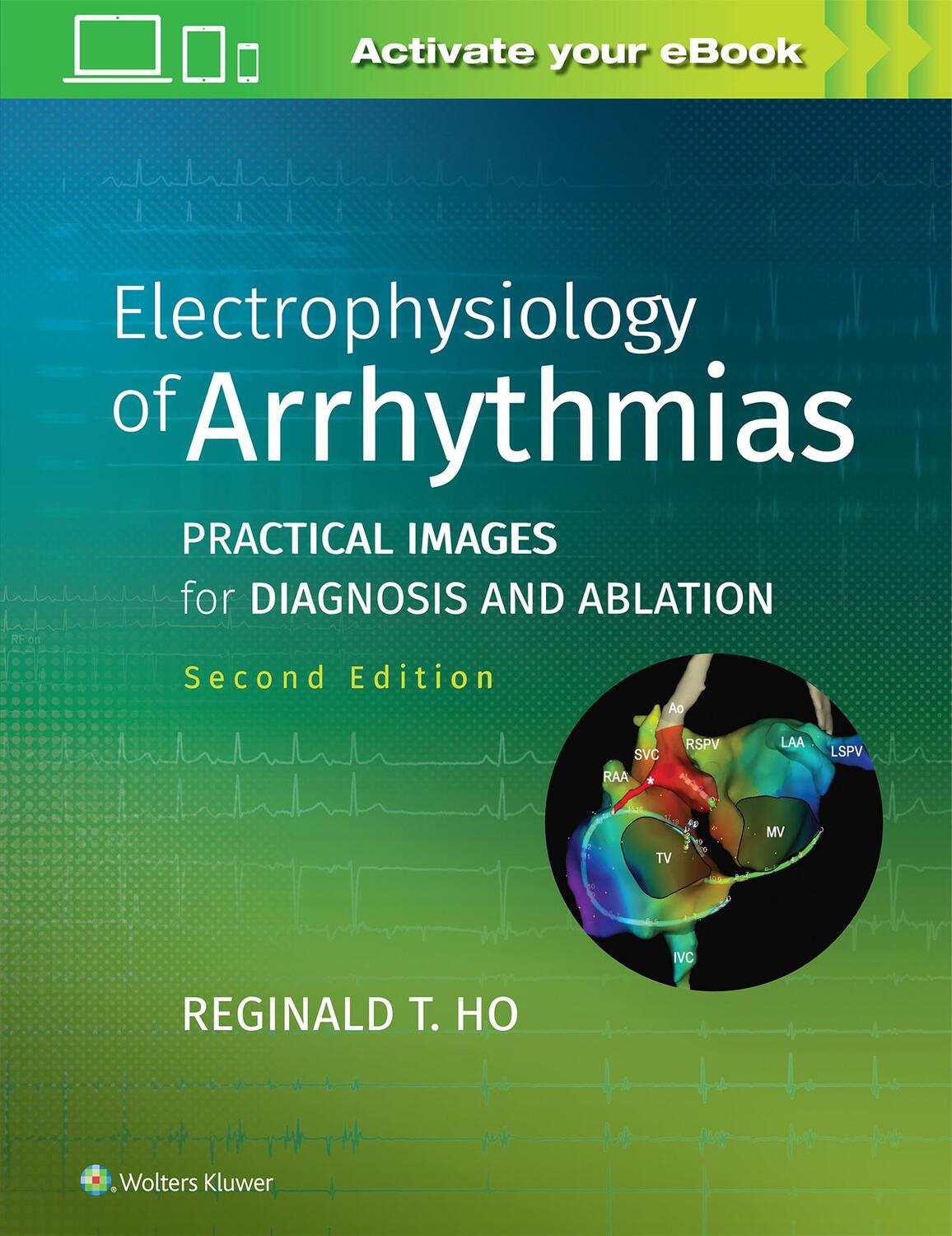 Cover: 9781975101107 | Electrophysiology of Arrhythmias | Reginald T. Ho | Buch | Englisch