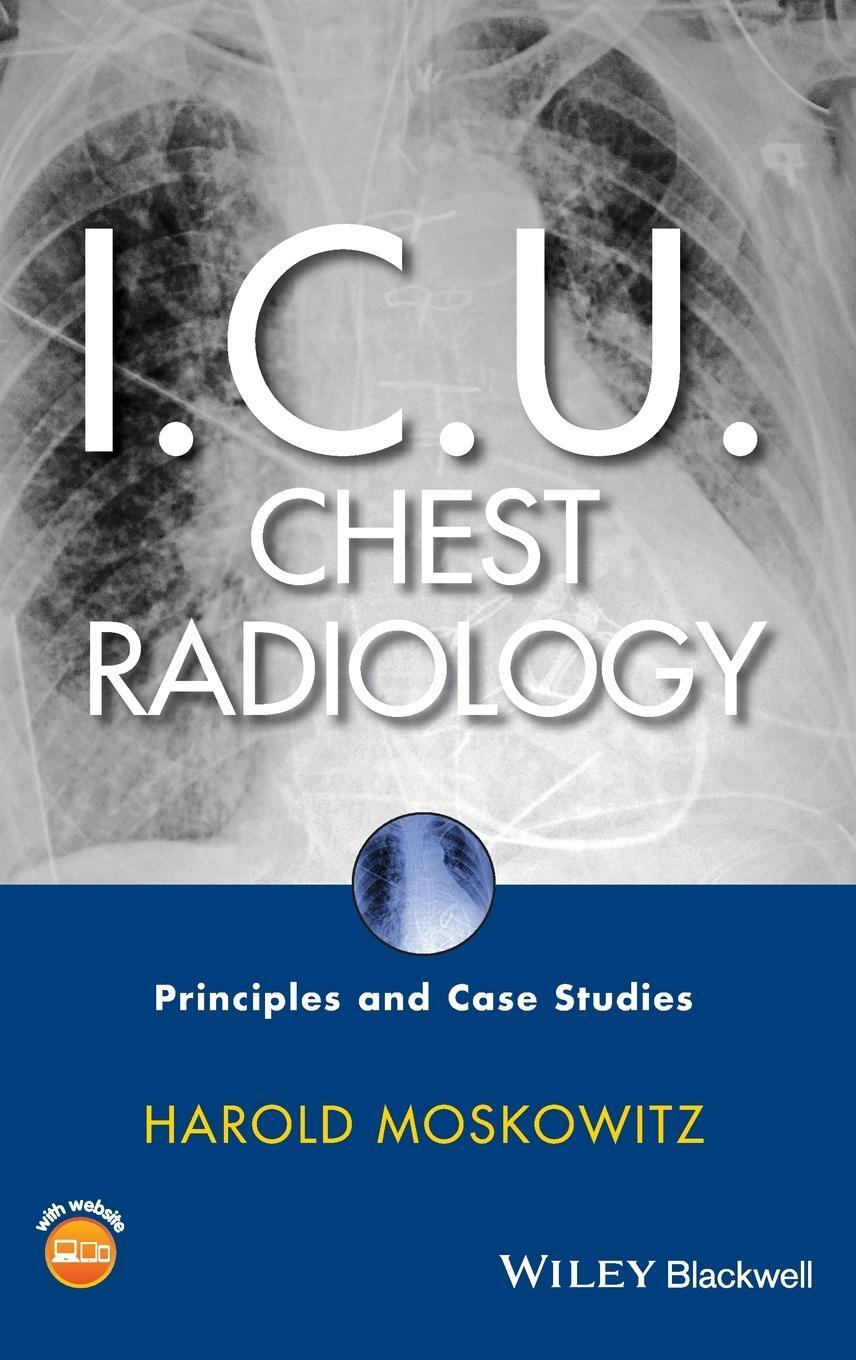 Cover: 9780470450345 | I.C.U. Chest Radiology | Harold Moskowitz | Buch | 208 S. | Englisch
