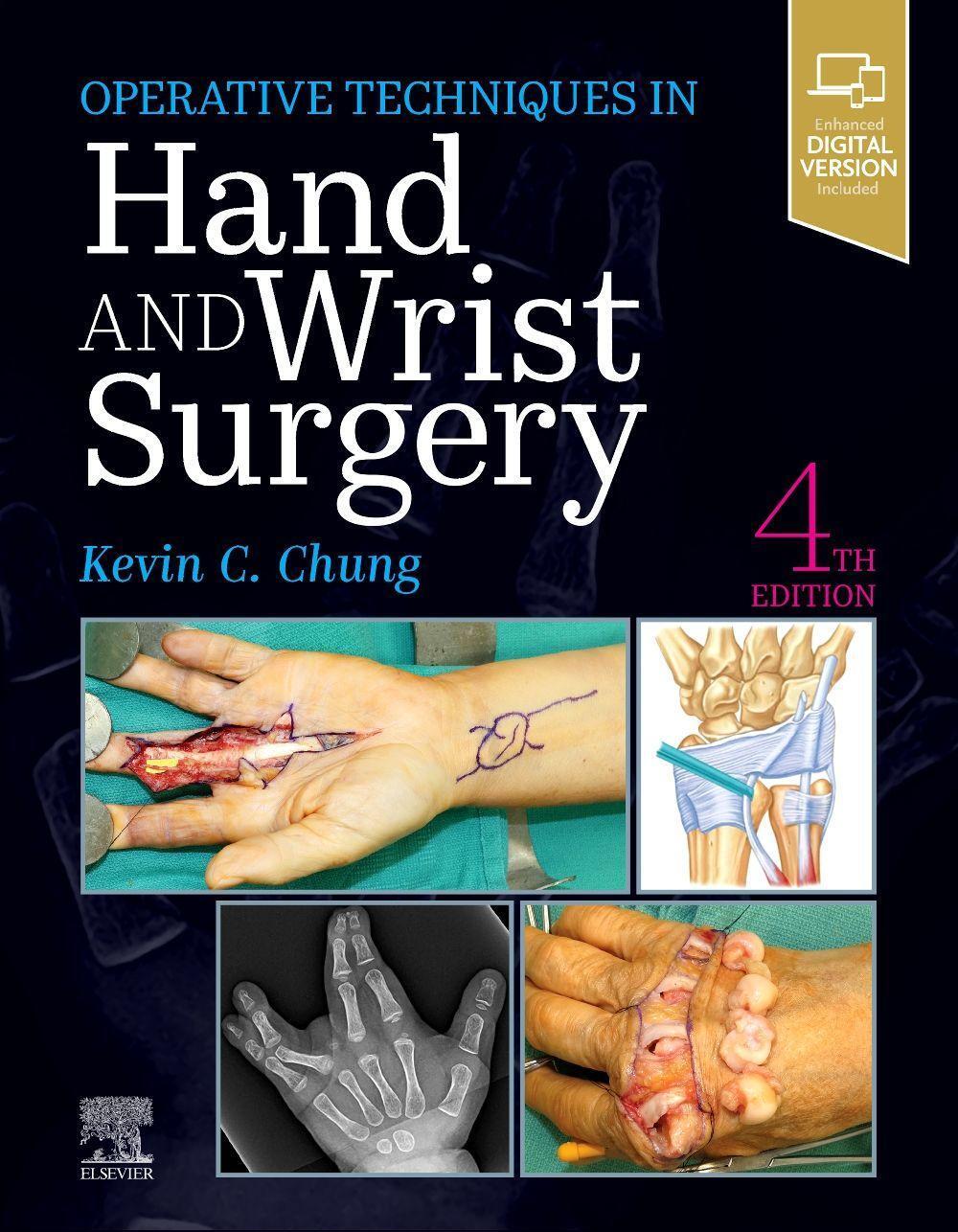 Cover: 9780323794152 | Operative Techniques: Hand and Wrist Surgery | Kevin C. Chung | Buch