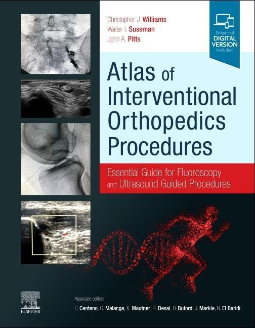 Cover: 9780323755146 | Atlas of Interventional Orthopedics Procedures | Williams (u. a.)