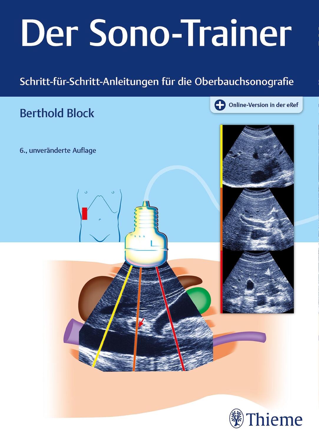 Cover: 9783132444324 | Der Sono-Trainer | Berthold Block | Bundle | Mixed Media Product