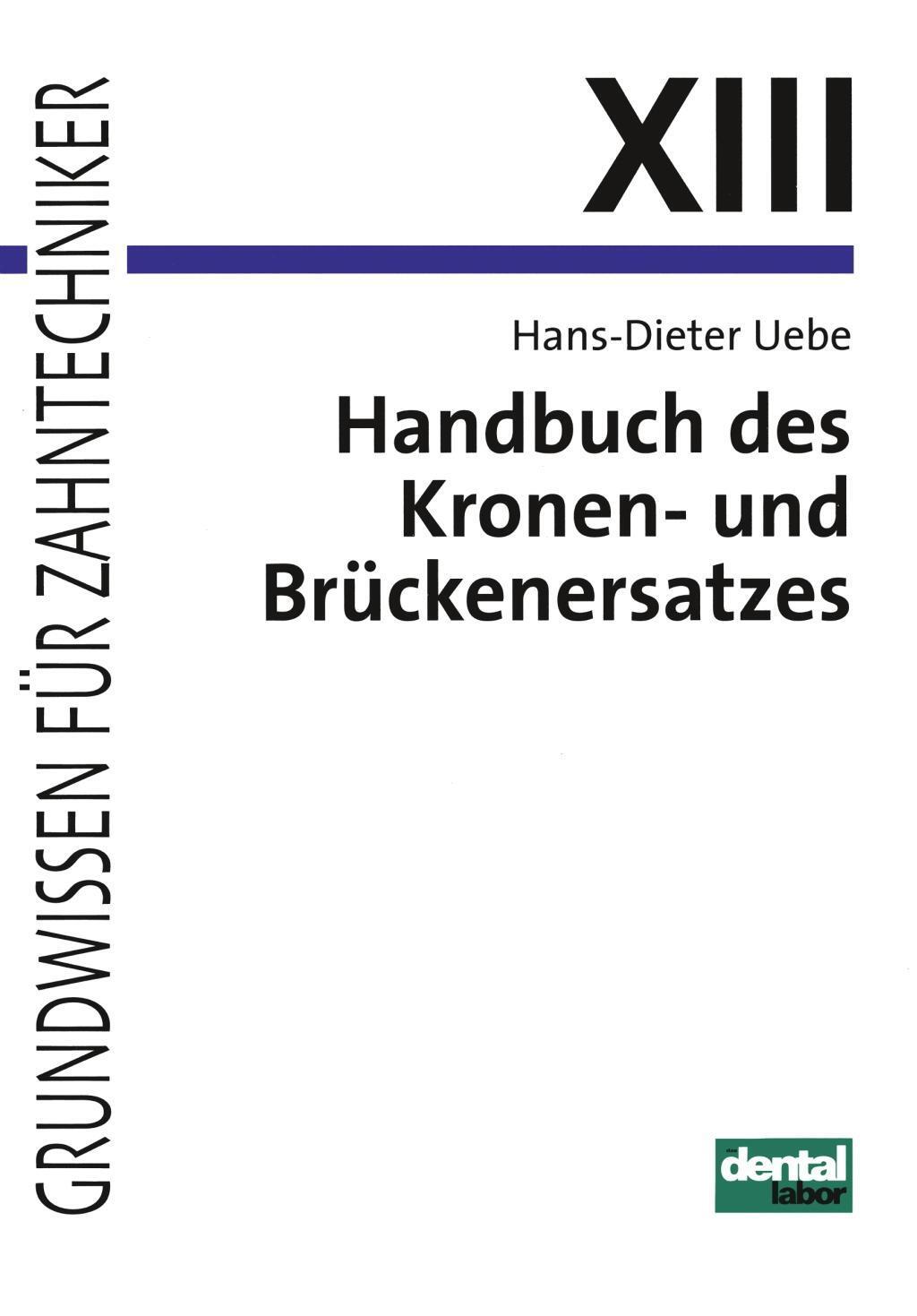 Cover: 9783929360097 | Handbuch des Kronen- und Brückenersatzes | Hans-Dieter Uebe | Buch