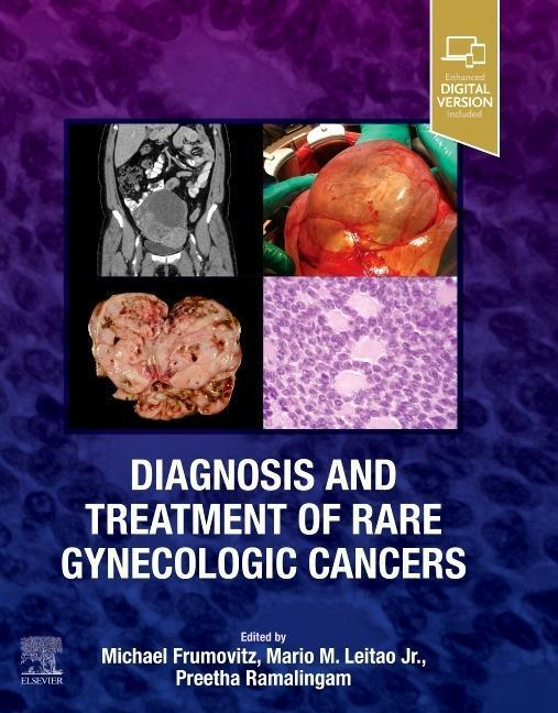 Cover: 9780323829380 | Diagnosis and Treatment of Rare Gynecologic Cancers | Buch | Englisch