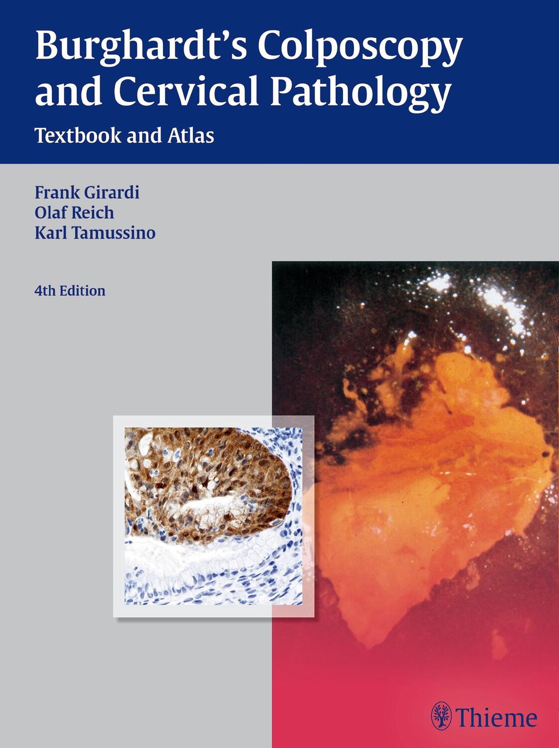 Cover: 9783136599044 | Burghardt's Colposcopy and Cervical Pathology | Textbook and Atlas
