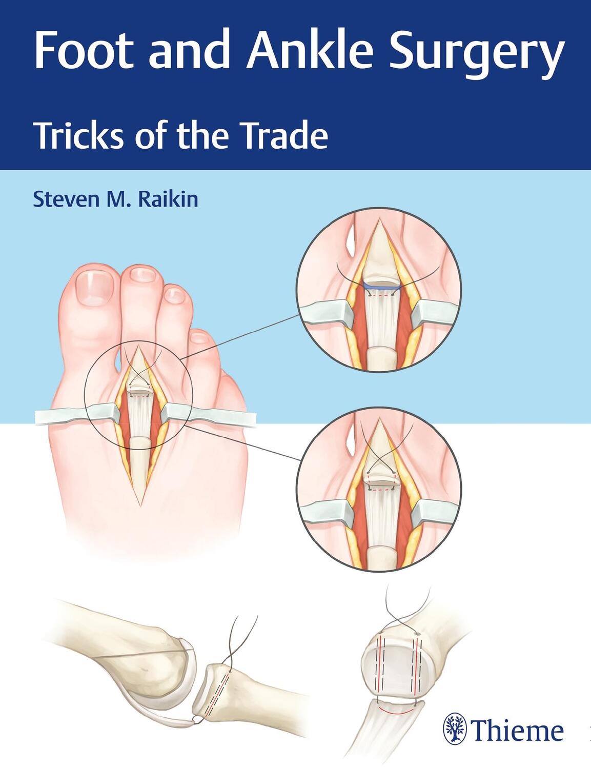 Cover: 9781626234918 | Foot and Ankle Surgery | Tricks of the Trade | Steven Raikin | Buch