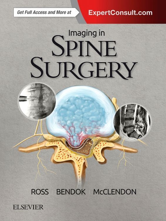 Cover: 9780323485548 | Imaging in Spine Surgery | Jeffrey S. Ross (u. a.) | Buch | Englisch