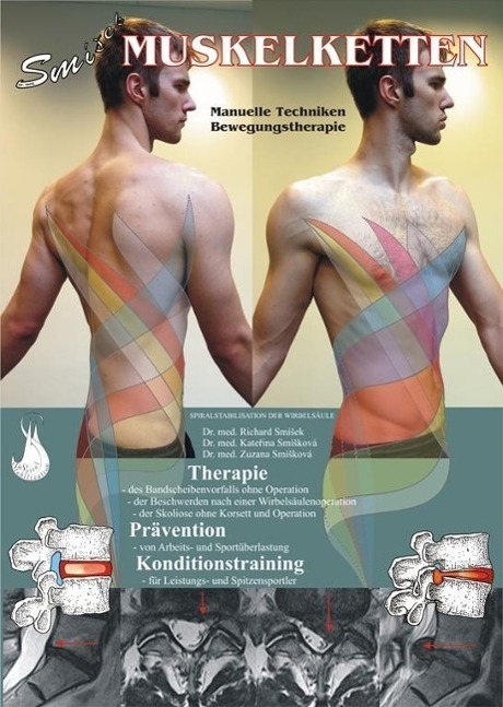 Cover: 9788087568699 | Muskelketten | Manuelle Techniken, Bewegungstherapie | Smisek (u. a.)