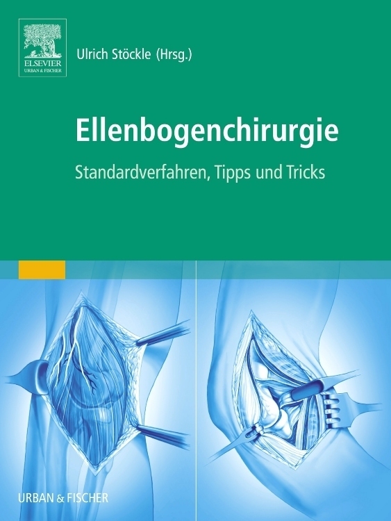Cover: 9783437314995 | Ellenbogenchirurgie | Atlas zu Standardverfahren, Tipps und Tricks