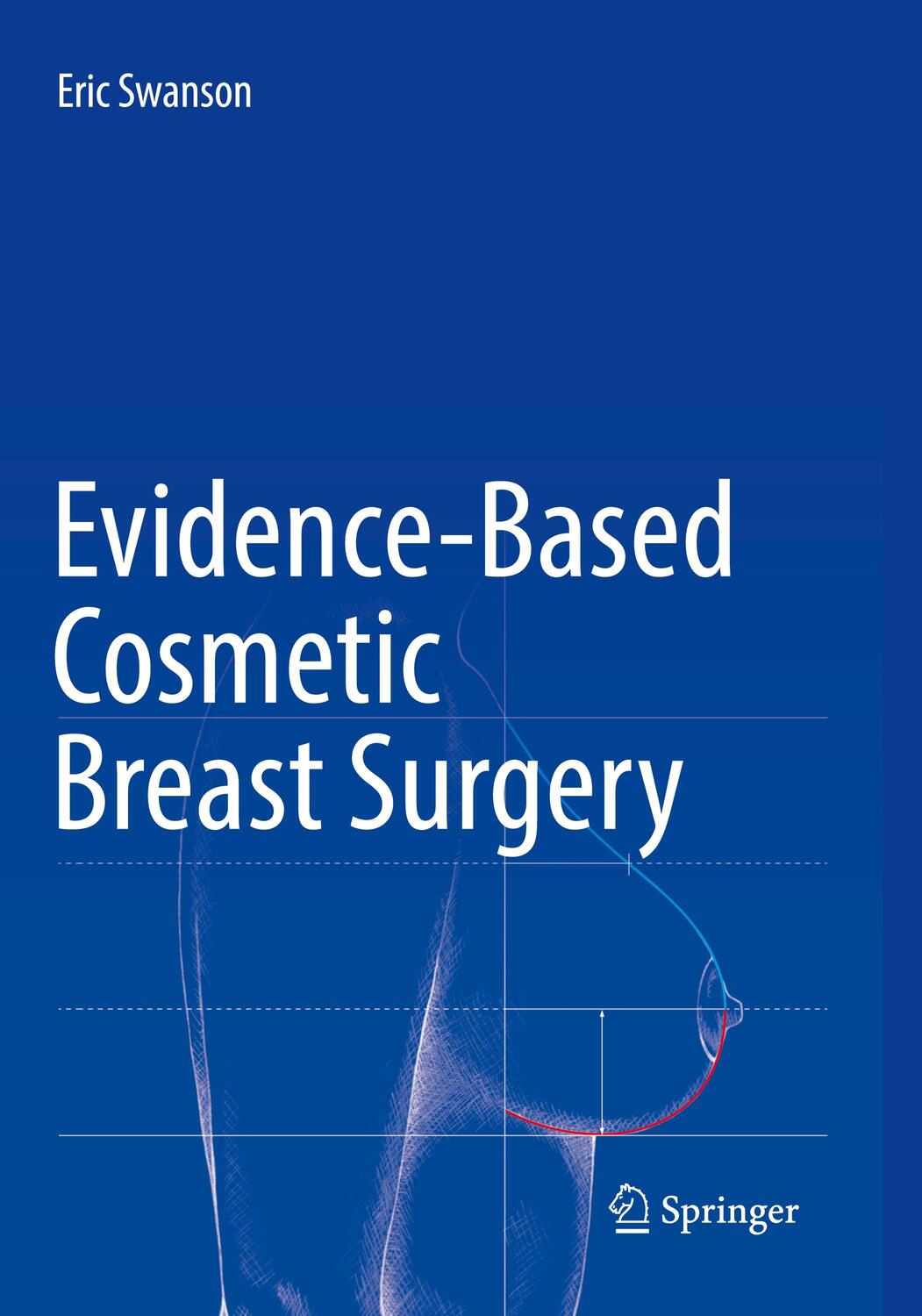 Cover: 9783319852850 | Evidence-Based Cosmetic Breast Surgery | Eric Swanson | Taschenbuch