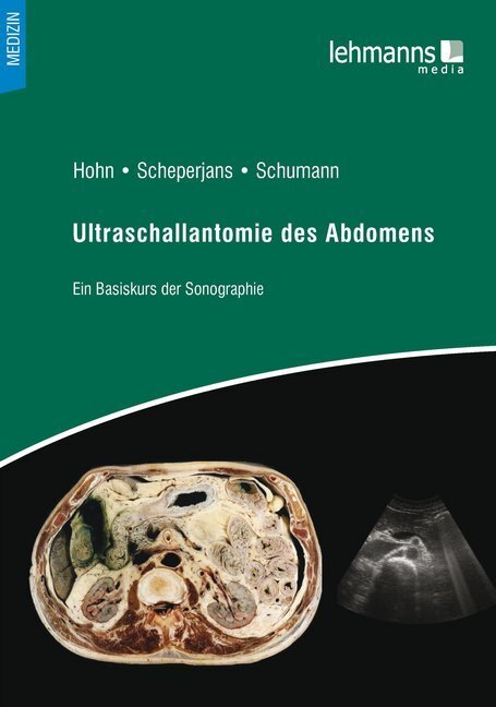 Cover: 9783865417923 | Ultraschallanatomie des Abdomens | Ein Basiskurs der Sonografie | Buch