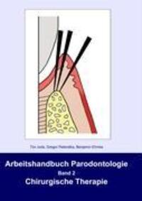 Cover: 9783837046359 | Arbeitshandbuch Parodontologie | Band 2 Chirurgische Therapie | Buch