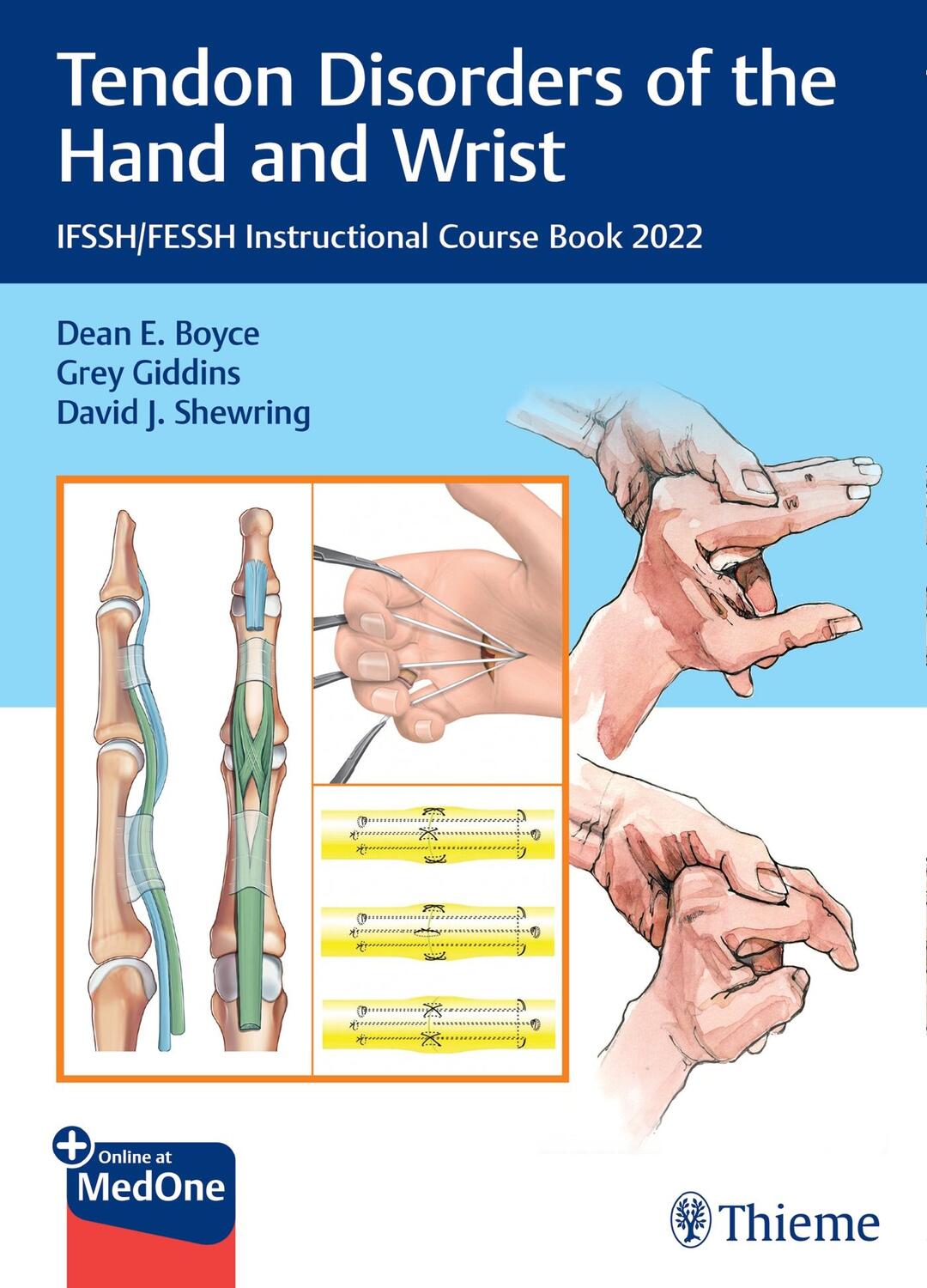 Cover: 9783132442214 | Tendon Disorders of the Hand and Wrist | Dean E. Boyce (u. a.) | 2022