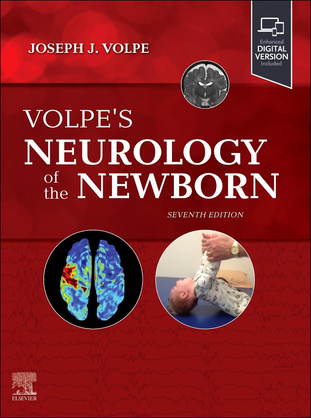 Cover: 9780443105135 | Volpe's Neurology of the Newborn | Joseph J Volpe (u. a.) | Buch