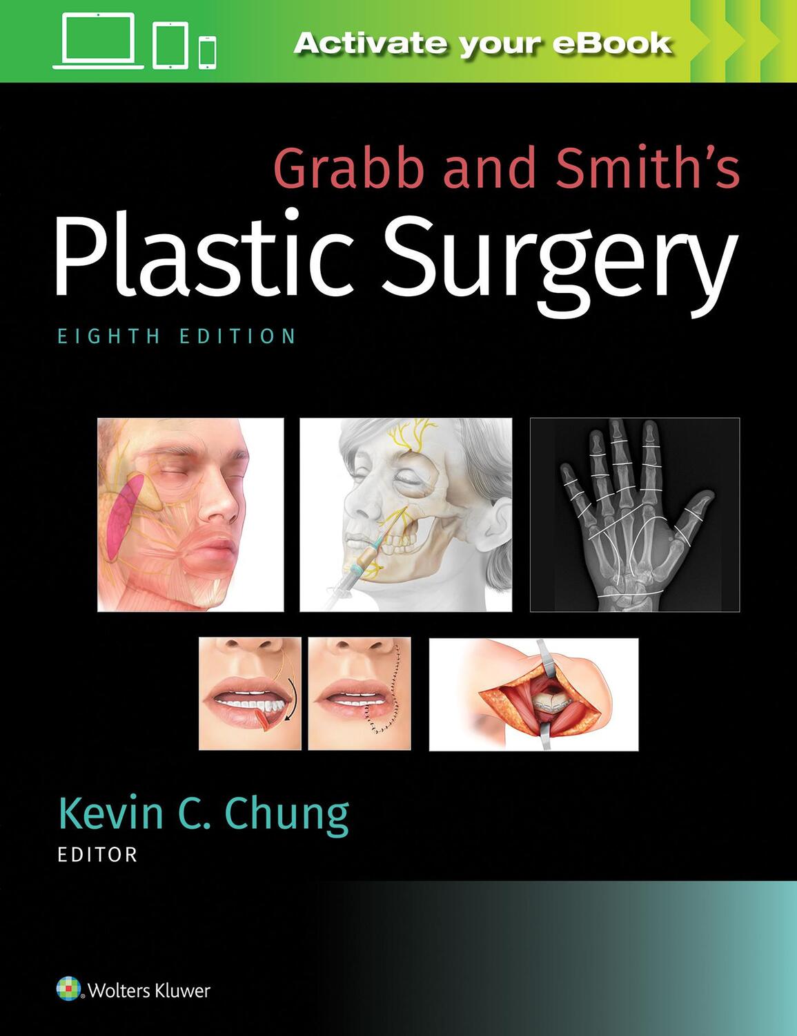 Cover: 9781496388247 | Grabb and Smith's Plastic Surgery | Kevin C. Chung | Buch | Gebunden