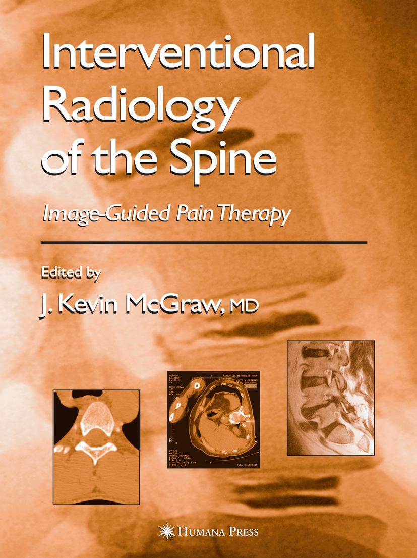 Cover: 9781617374197 | Interventional Radiology of the Spine | Image-Guided Pain Therapy