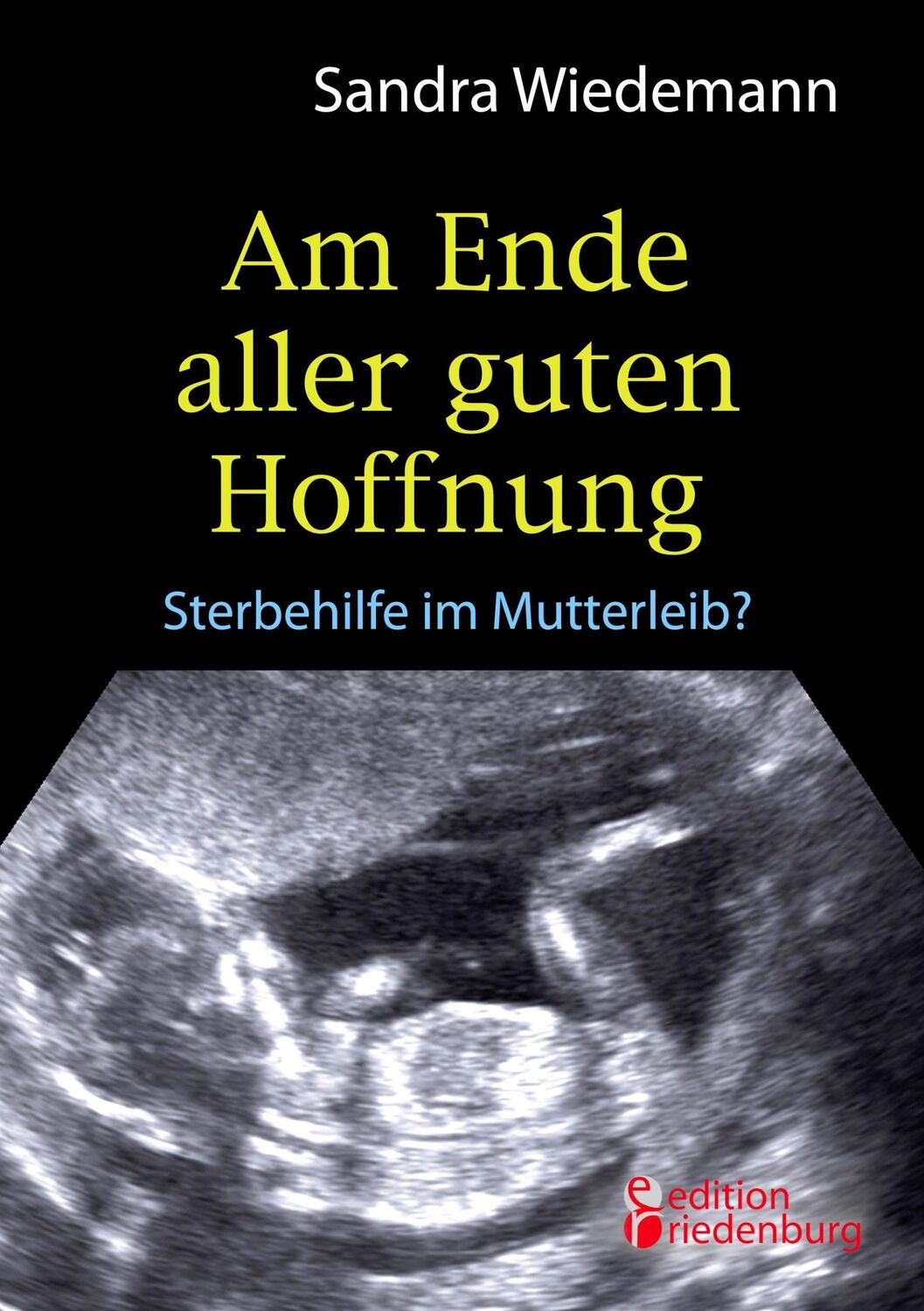 Cover: 9783902943613 | Am Ende aller guten Hoffnung - Sterbehilfe im Mutterleib? | Wiedemann