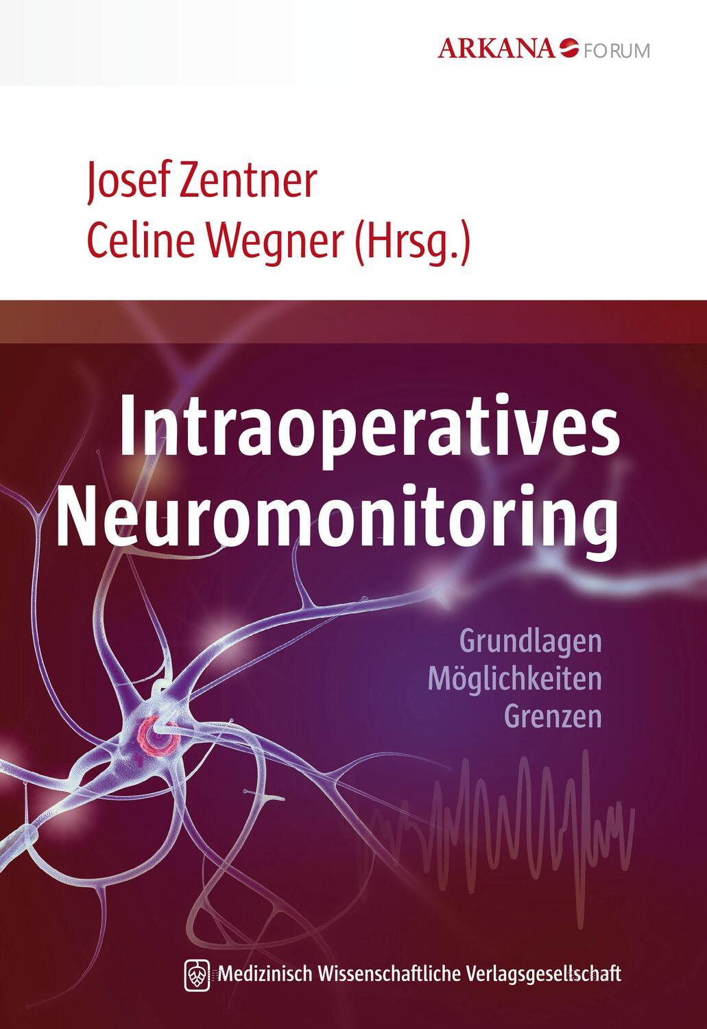 Cover: 9783954665013 | Intraoperatives Neuromonitoring | Grundlagen, Möglichkeiten, Grenzen