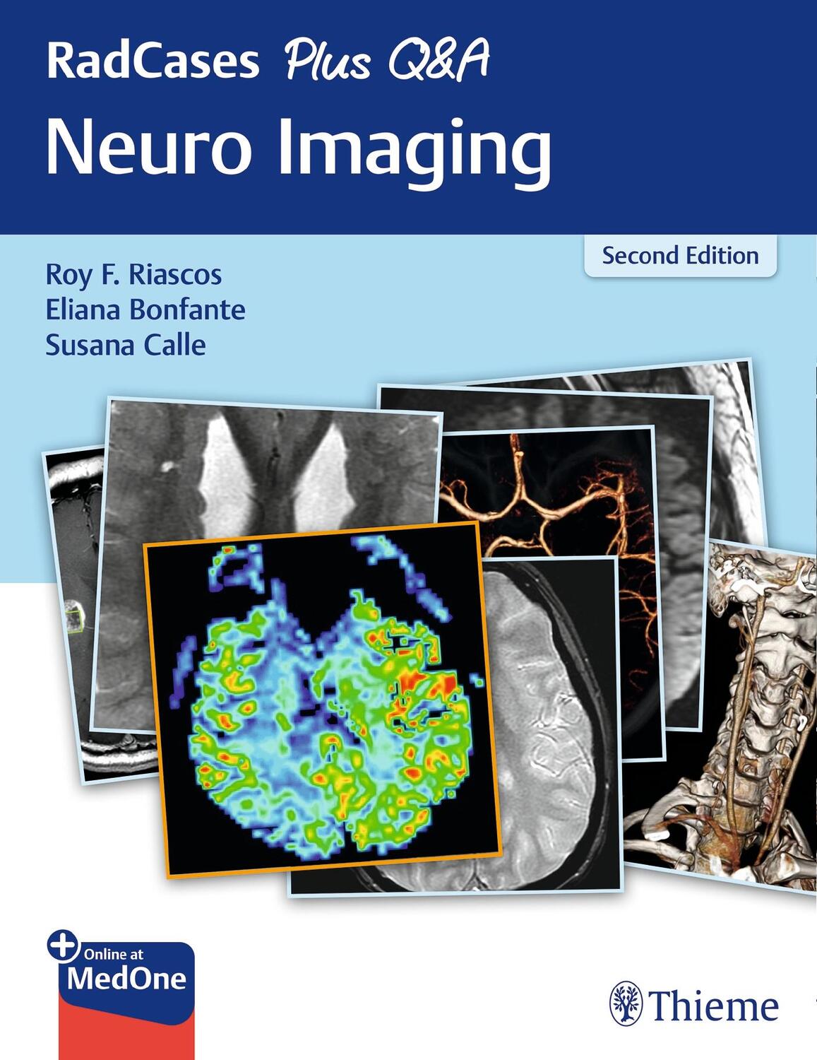 Cover: 9781626232372 | RadCases Plus Q&amp;A Neuro Imaging | Roy Riascos (u. a.) | Taschenbuch