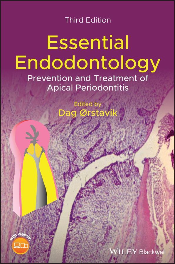 Cover: 9781119271956 | Essential Endodontology | Dag Orstavik | Buch | 408 S. | Englisch